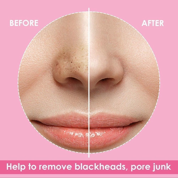 jolvka Blackhead Deep Cleansing Pore Strips For Nose 30 Pieces - Picture 5 of 6